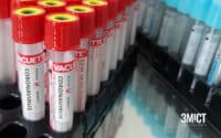 На Полтавщині – 11 випадків інфікування Covid-19