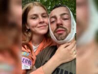 Двоє полтавських саперів підірвалися на міні та отримали сильні опіки: потрібна допомога