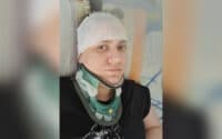 Складна операція в Барселоні: жінка з Полтавщини потребує допомоги у лікуванні