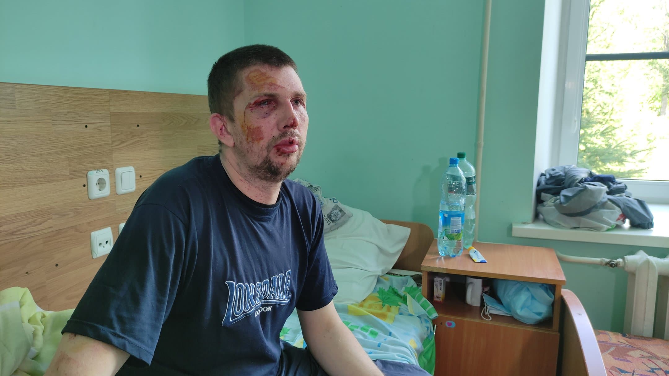 Постраждалий Сергій Іванов у лікарні