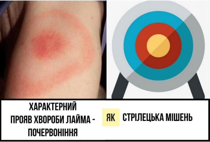 Кліщ