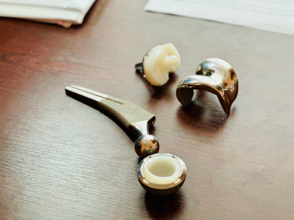 ендопротезування