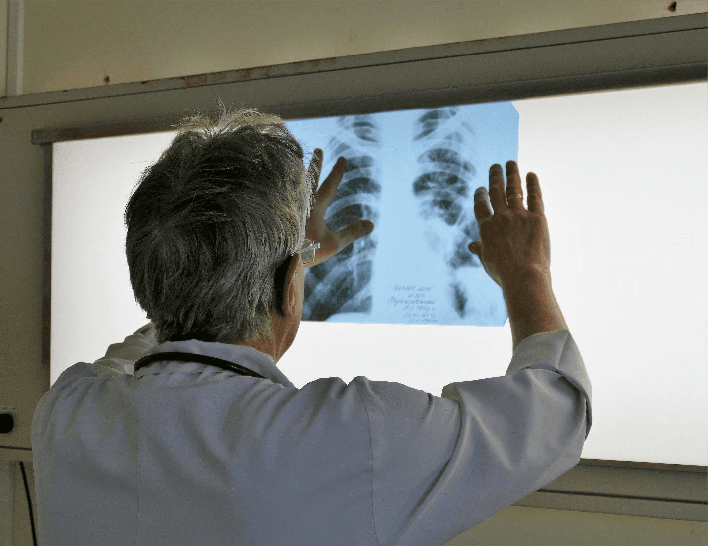 Ілюстративне фото. Фтизіатричне відділення Центру легеневого здоров’я у Львові